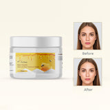 Bee Venom Mole and Wart Treatment Cream 100 gm Pack of 1